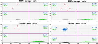 Methodological Challenges of Digital PCR Detection of the Histone H3 K27M Somatic Variant in Cerebrospinal Fluid